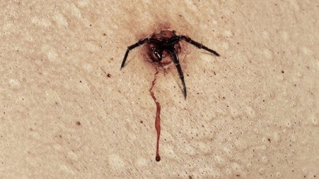 The Plague