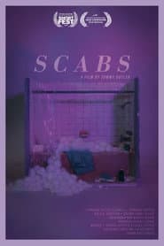 Scabs